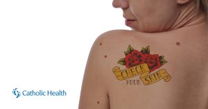 The Skin-ny on Skin Checks