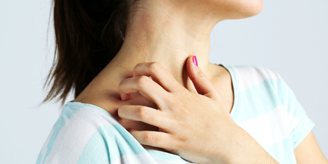 How to Treat Allergic Reactions