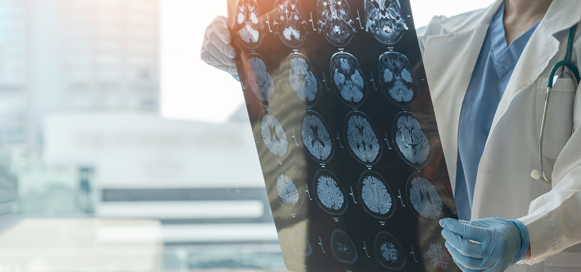 Doctor studying a brain scan