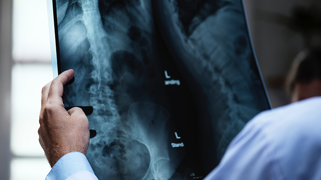Physician studying an x-ray radiograph